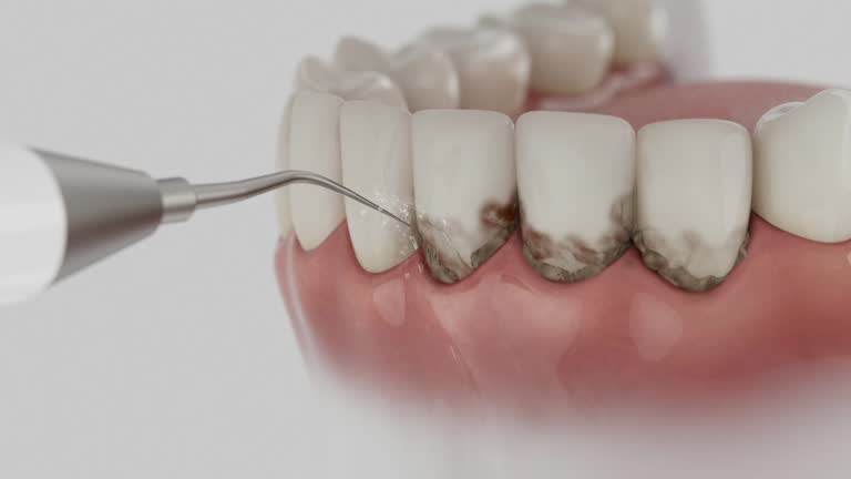 Reliable Dental contractor in Perry, UT by Smile Center Dentistry